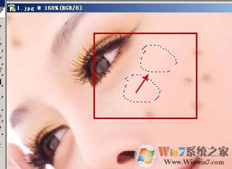 照片的臉上長痘痘怎么調？教你照片臉上長痘痘怎么去除